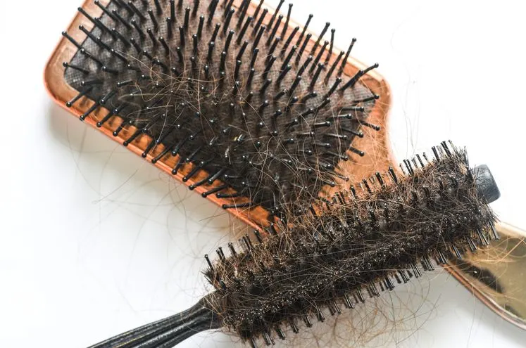 Jarang Membersihkan Sisir
