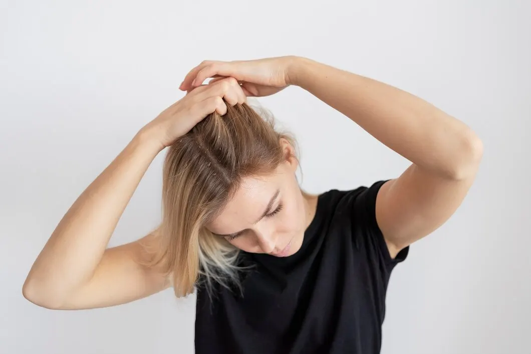 Produk Perawatan Rambut yang Ampuh Melawan Kutu