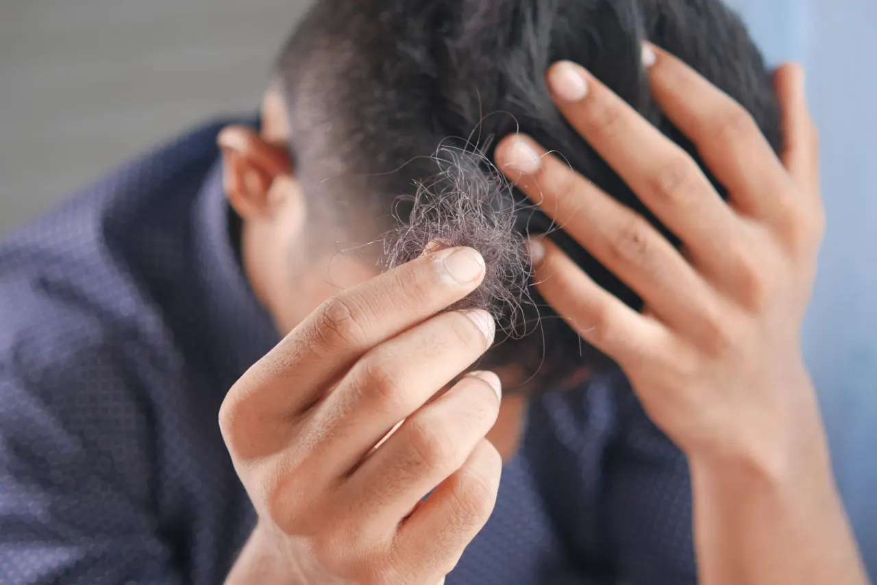 Hubungan Hormon dan Rambut Rontok pada Pria: Kenali Penyebabnya Sebelum Terlambat!