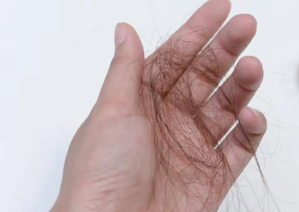 10 Tips Ampuh Mencegah Rambut Rontok Sejak Dini (Santai Tapi Efektif!)