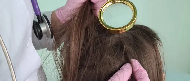 Cara Ampuh Atasi Alergi pada Produk Rambut