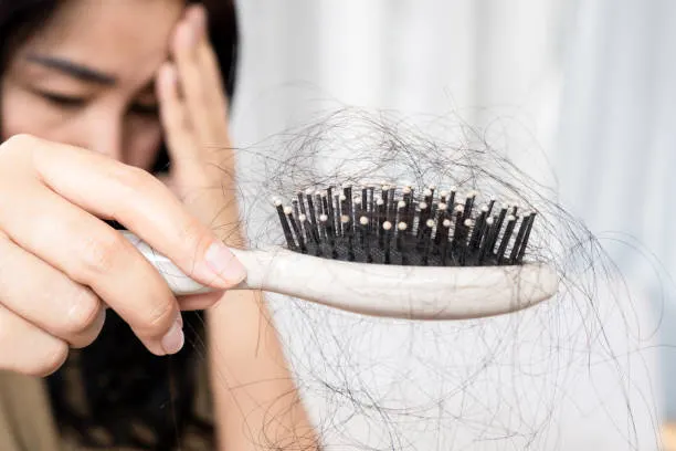 Kenali Penyakit Autoimun pada Rambut dan Cara Mengatasinya