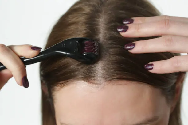 5 Tips Mengatasi Rambut yang Menipis di Beberapa Bagian