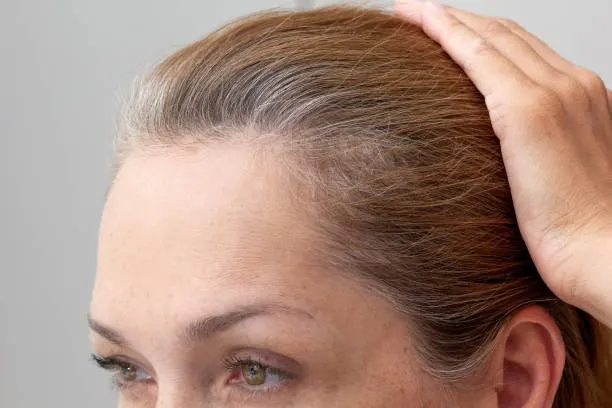 Kenapa Rambut Kamu Nggak Tumbuh Panjang? Ini Alasannya dan Cara Mengatasinya!