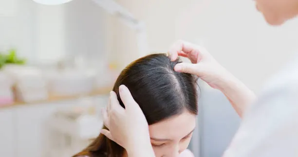 Manfaat Tea Tree Oil untuk Kulit Kepala Bermasalah