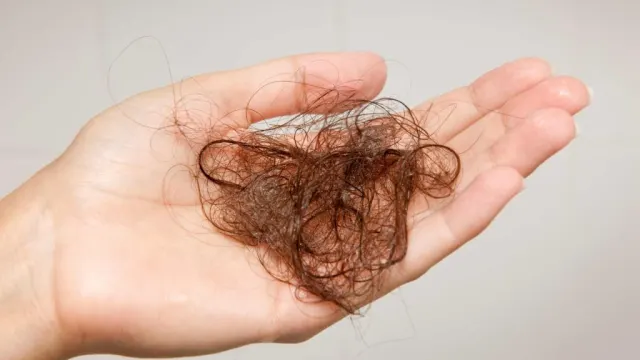 Rambut Rontok Berlebihan? Kenali Penyebab dan Cara Mengatasinya