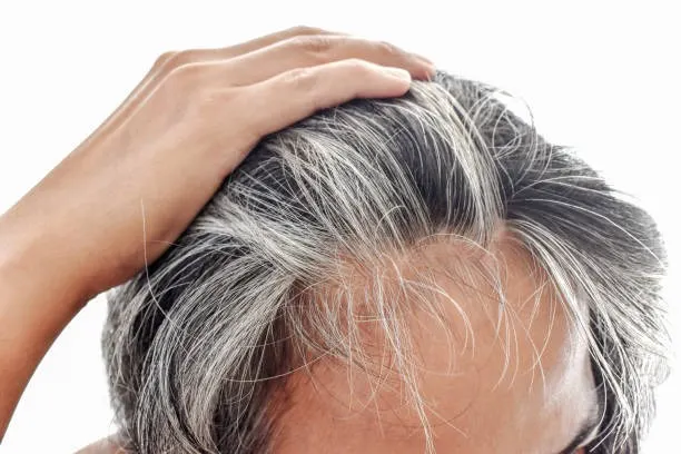 Jangan Panik! Ini Alasan Rambut Mulai Beruban