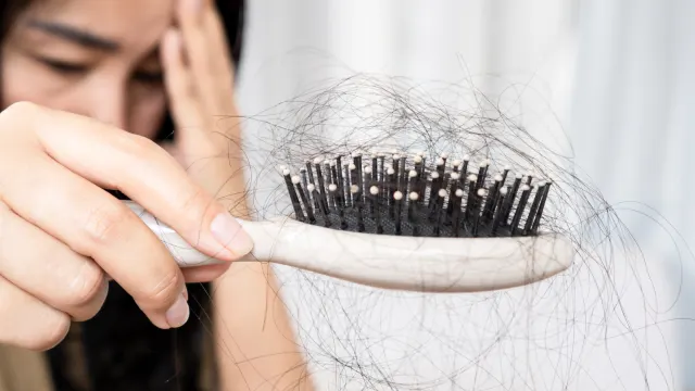 Bukan Cuma Stres! Waspadai Telogen Effluvium, Rambut Rontok yang Sering Tidak Disadari