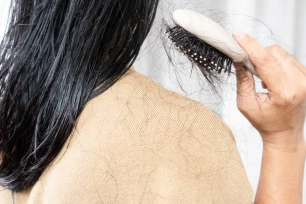 5 Cara Efektif Merawat Rambut Rontok Akibat Stres dengan Cara Santai dan Alami